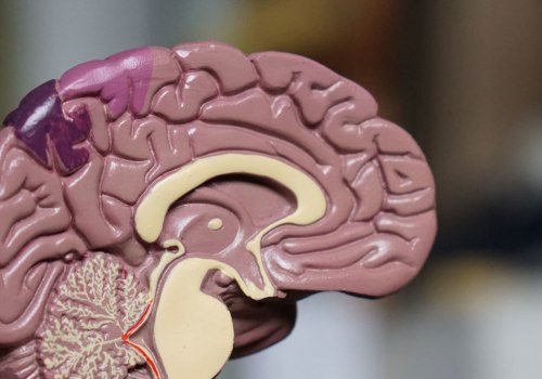 What Addiction Does to the Brain: A Comprehensive Guide