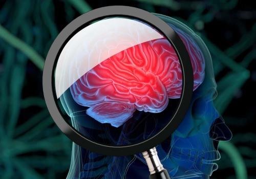 The Brain's Role in Addiction: How Does It Affect Us?